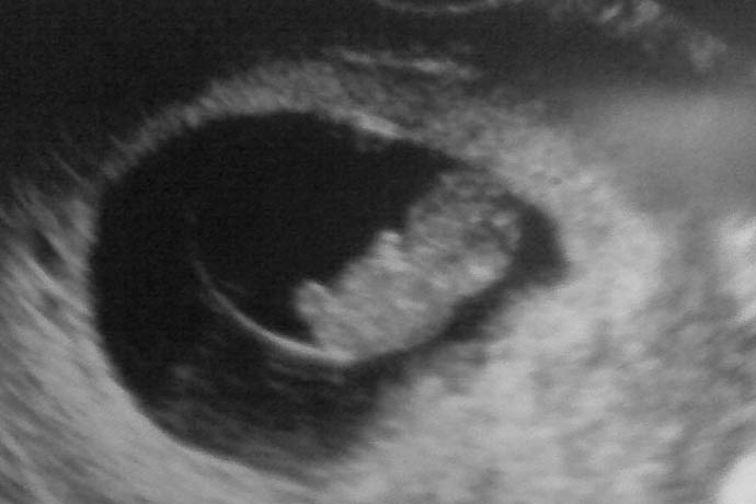 My Niece or Nephew To Be at nine weeks -- http://regex.info/blog/